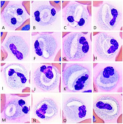 A mystery revealed: an update on eosinophil and other blood cell morphology of the Argentine black and white tegu (Salvator merianae)